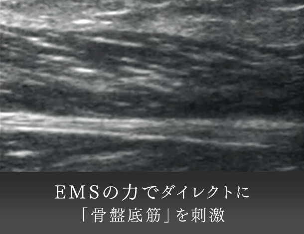 バスタイム骨盤底筋トレーニング | マイトレックス | MT-AQ24B バスタイム骨盤底筋トレーニング | マイトレックス | MT-AQ24B